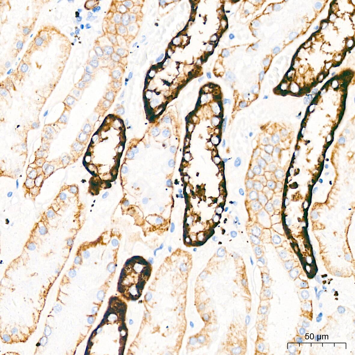 Glutamate Receptor 6 Antibody (4B4L9)