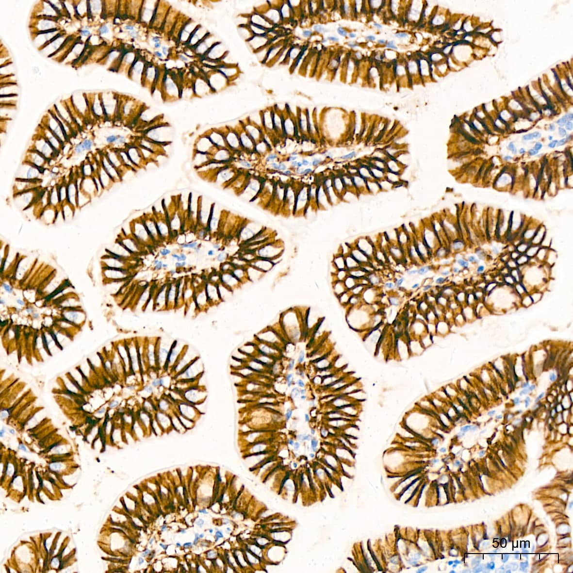 Glutamate Receptor 6 Antibody (4B4L9)