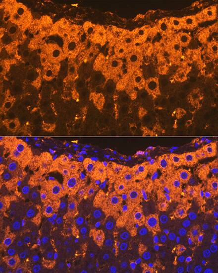 alpha 2-Macroglobulin Antibody (7V6M10)