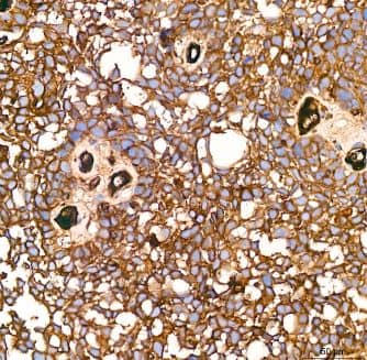 alpha 2-Macroglobulin Antibody (7V6M10)