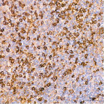 alpha 2-Macroglobulin Antibody (7V6M10)