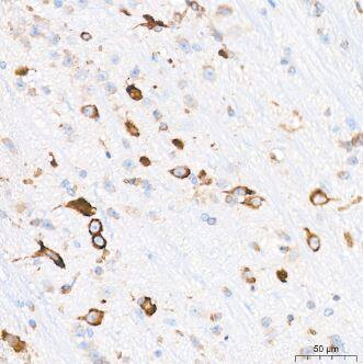 alpha 2-Macroglobulin Antibody (7V6M10)