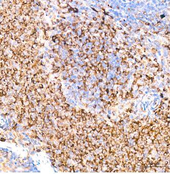 alpha 2-Macroglobulin Antibody (7V6M10)