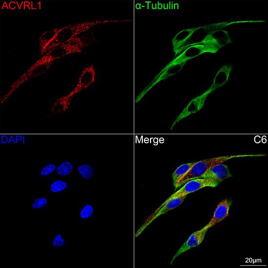 ALK-1 Antibody (8L2V7)