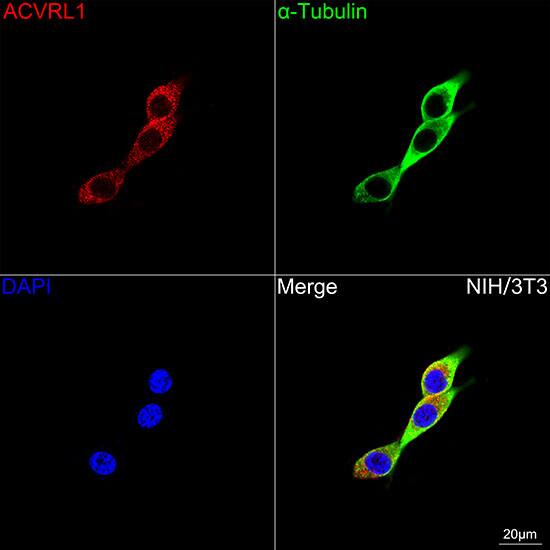 ALK-1 Antibody (8L2V7)