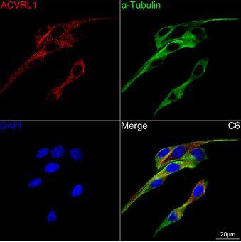 ALK-1 Antibody (8L2V7)