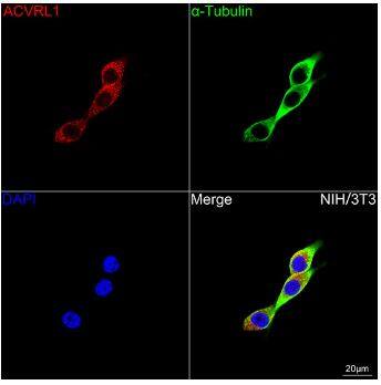 ALK-1 Antibody (8L2V7)