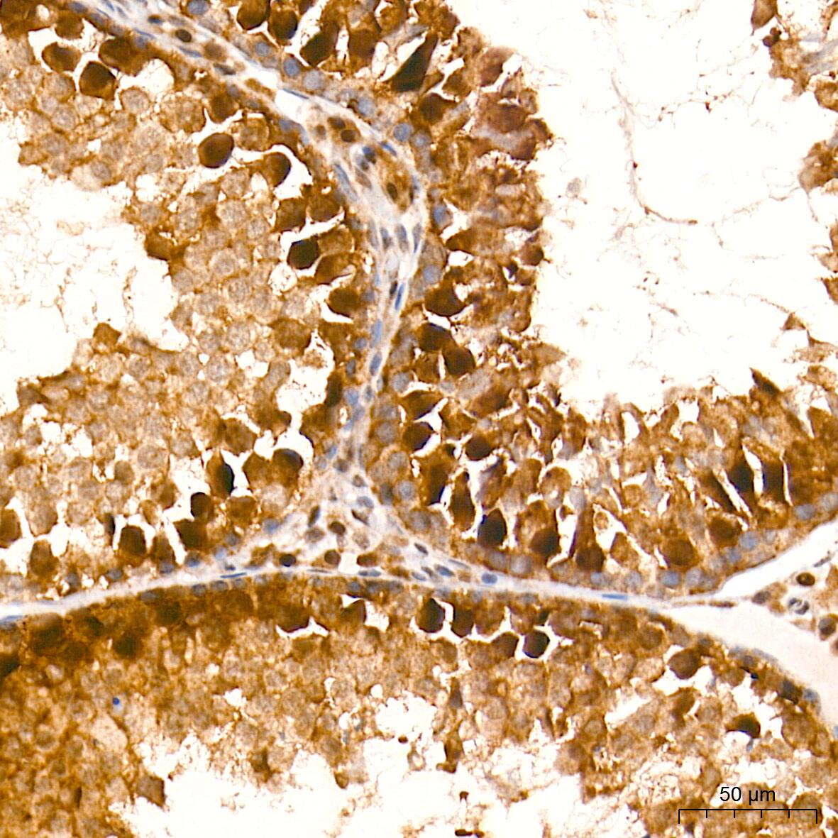 HES5 Antibody (4S4U7)