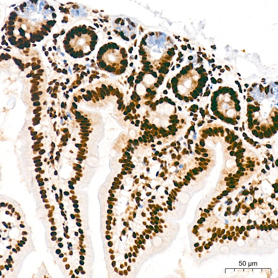 RNA Polymerase II/POLR2A [p Ser5] Antibody (10C7U2)