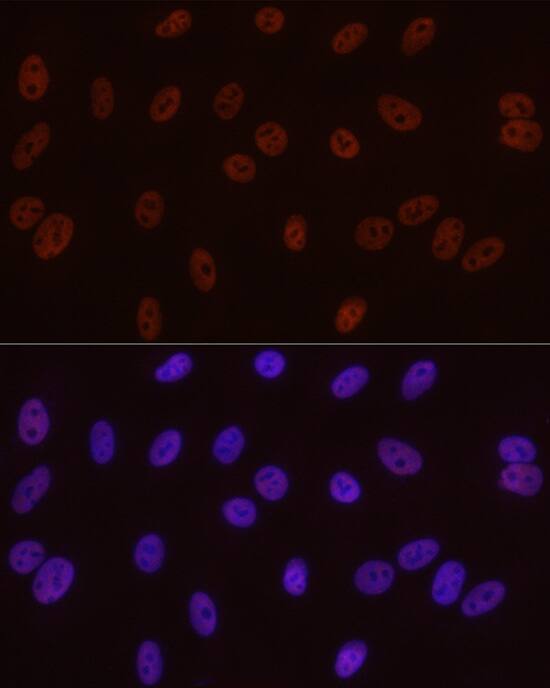 RNA Polymerase II/POLR2A [p Ser5] Antibody (10C7U2)