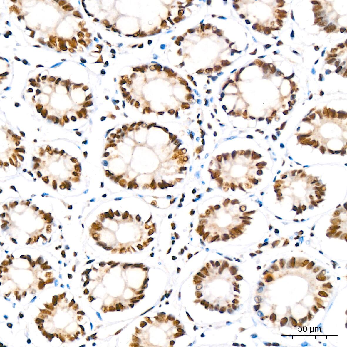 IkB-alpha [p Ser36] Antibody (8G1X10)