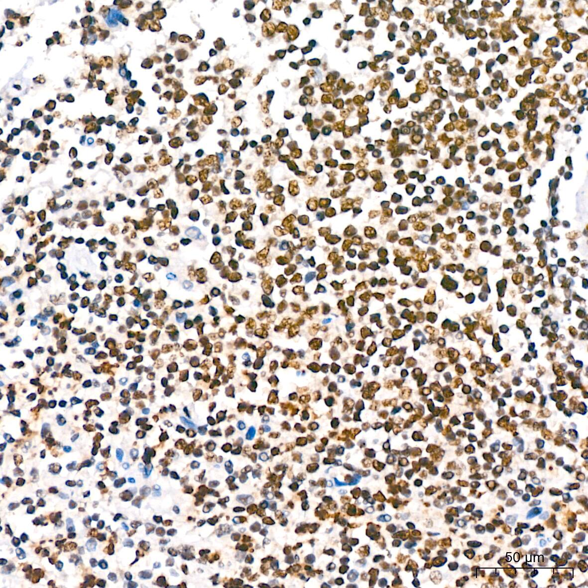 IkB-alpha [p Ser36] Antibody (8G1X10)