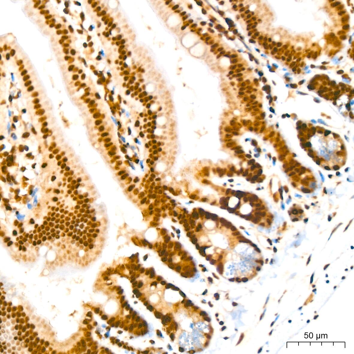 IkB-alpha [p Ser36] Antibody (8G1X10)