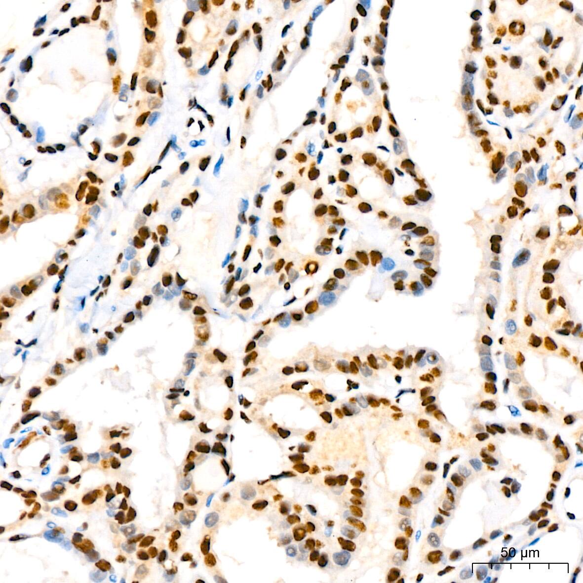 IkB-alpha [p Ser36] Antibody (8G1X10)