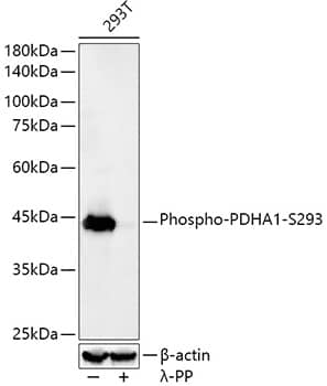 Pyruvate Dehydrogenase E1-alpha subunit [p Ser293] Antibody (6E3J0)