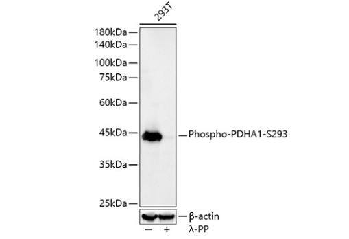 Pyruvate Dehydrogenase E1-alpha subunit [p Ser293] Antibody (6E3J0)