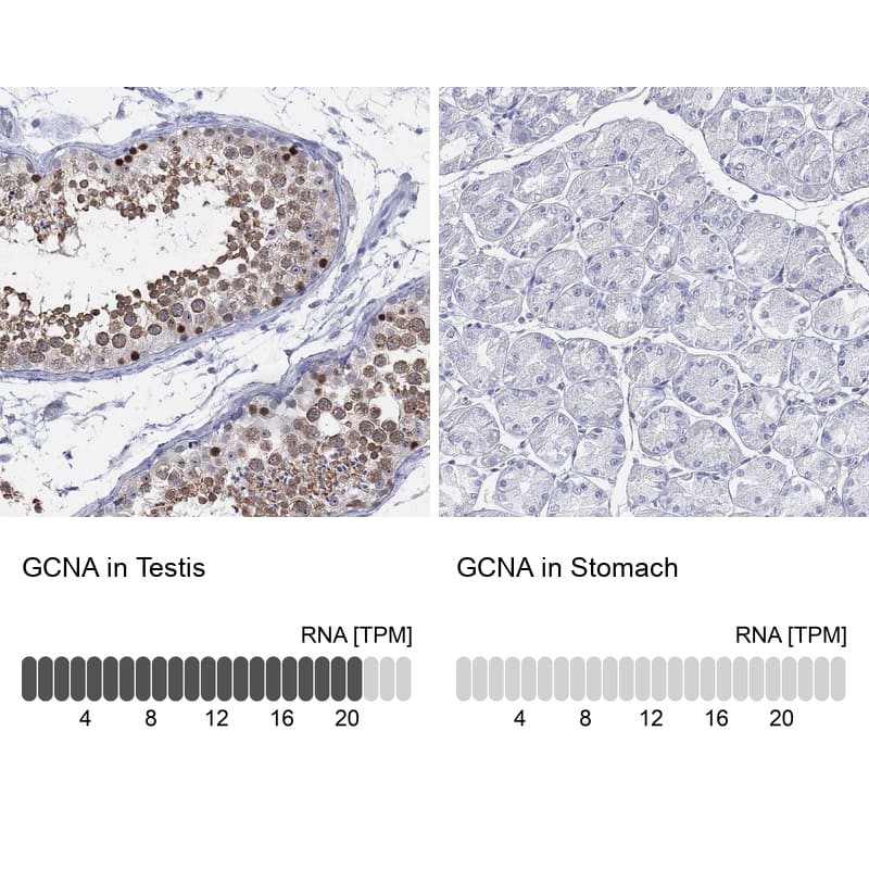 ACRC Antibody - BSA Free Immunohistochemistry-Paraffin: ACRC Antibody [NBP3-17118]