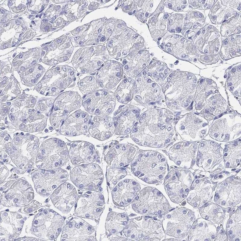 ACRC Antibody - BSA Free Immunohistochemistry-Paraffin: ACRC Antibody [NBP3-17118]