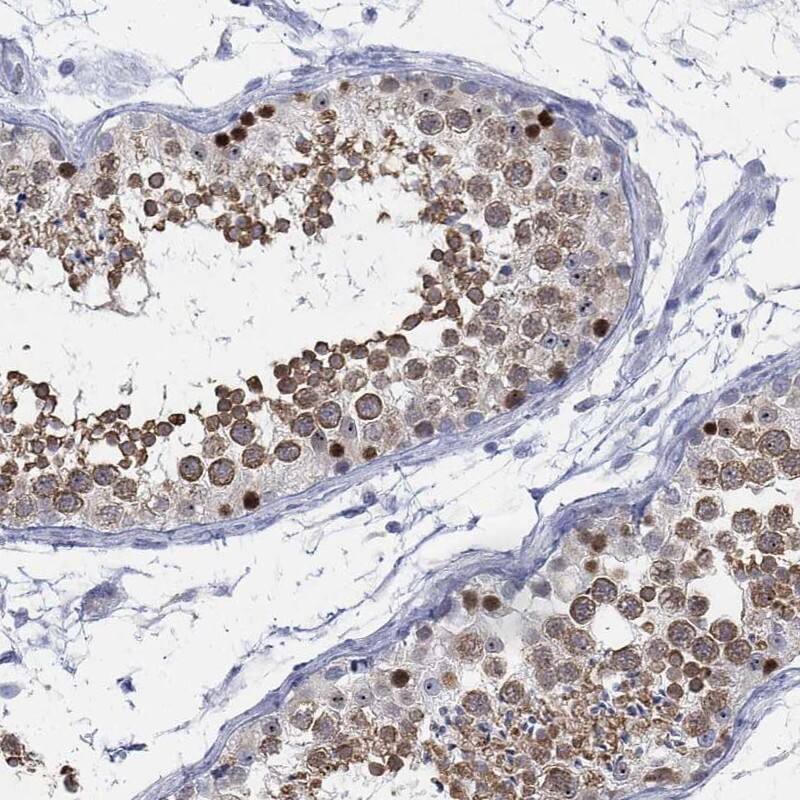 ACRC Antibody - BSA Free Immunohistochemistry-Paraffin: ACRC Antibody [NBP3-17118]