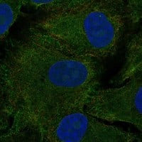 Dopamine D1R/DRD1 Antibody - BSA Free Immunocytochemistry/ Immunofluorescence: Dopamine D1R/DRD1 Antibody [NBP3-17644]