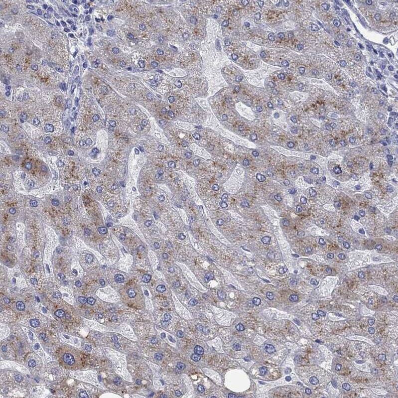 Apolipoprotein CIII Antibody Immunohistochemistry-Paraffin: Apolipoprotein CIII Antibody [NBP3-17685] -