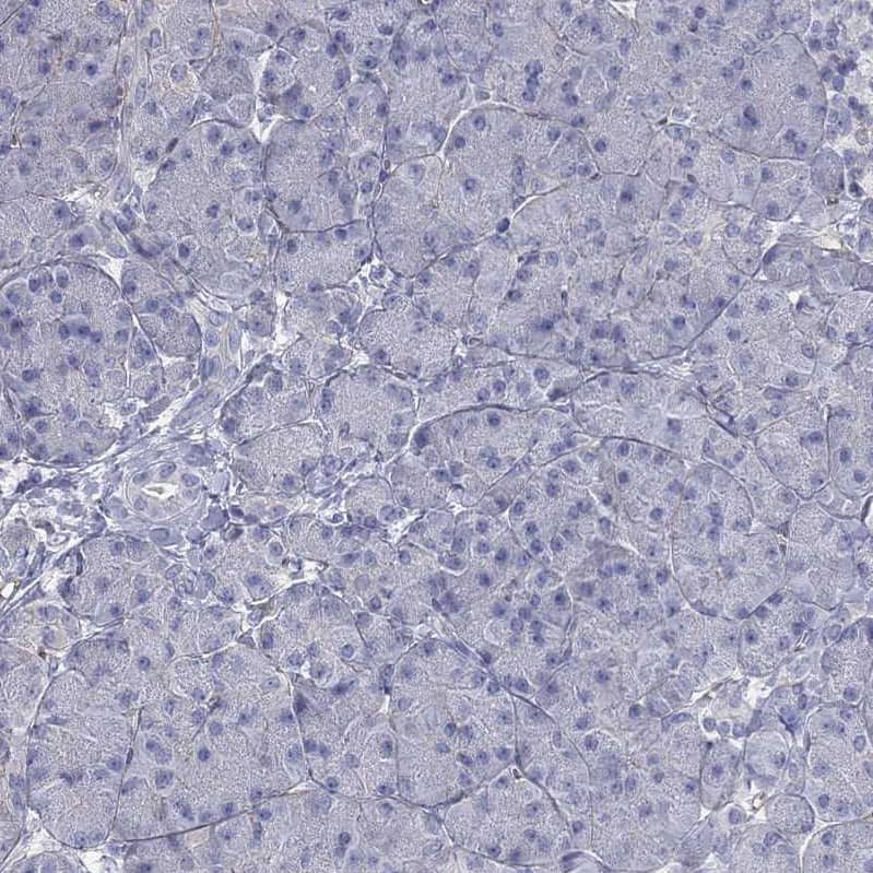 Apolipoprotein CIII Antibody Immunohistochemistry-Paraffin: Apolipoprotein CIII Antibody [NBP3-17685] -