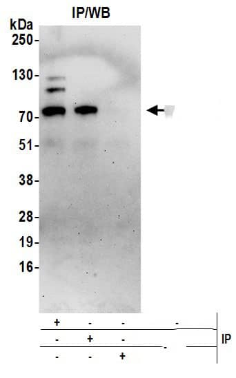 APBA3/Mint-3 Antibody