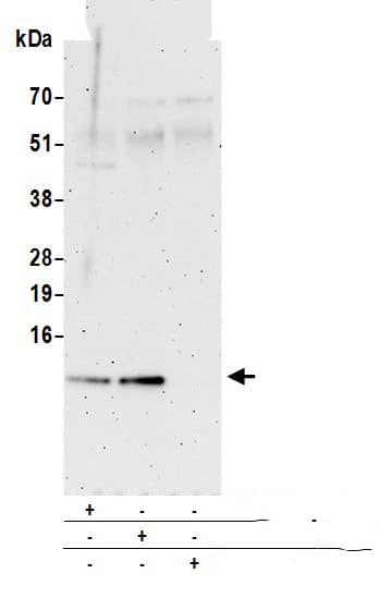 S100A16 Antibody