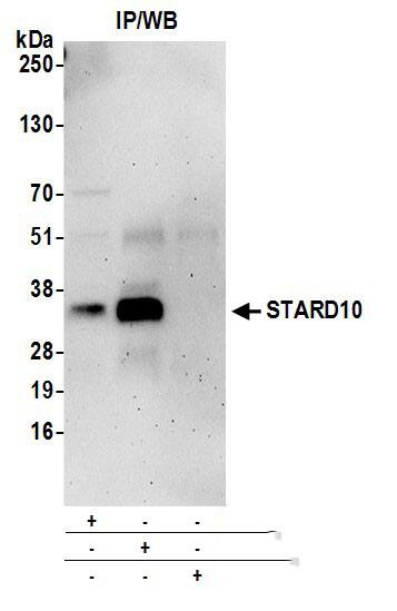 STARD10 Antibody