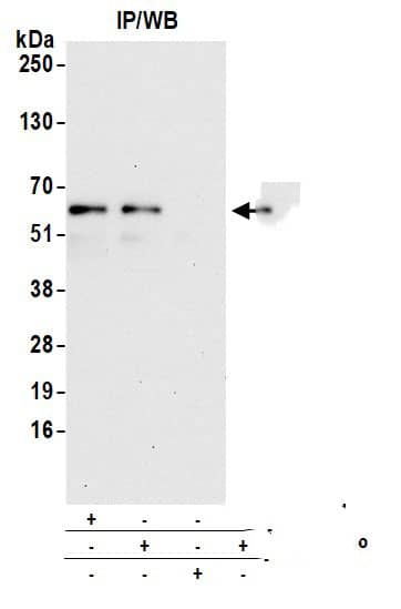 CLCC1 Antibody