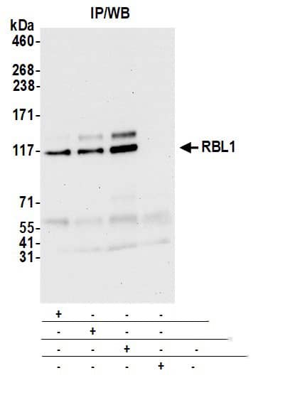 p107 Antibody