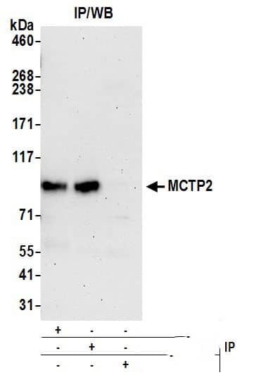 MCTP2 Antibody