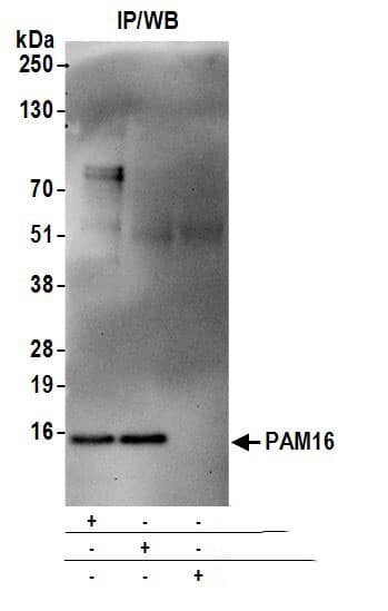 Magmas Antibody