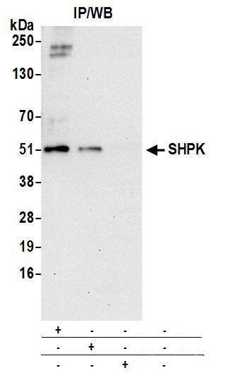 CARKL Antibody