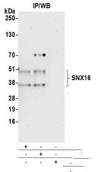 SNX16 Antibody