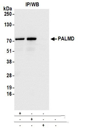 PALMD Antibody
