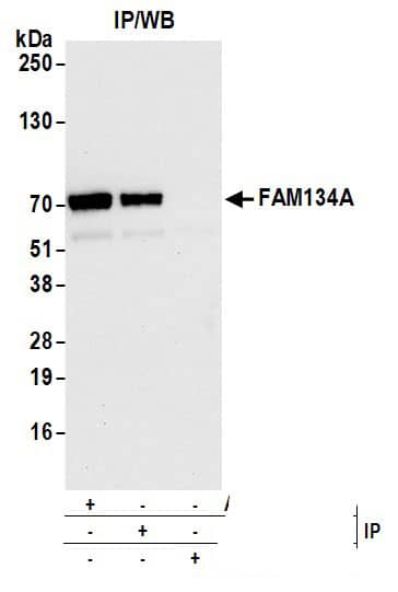 FAM134A Antibody