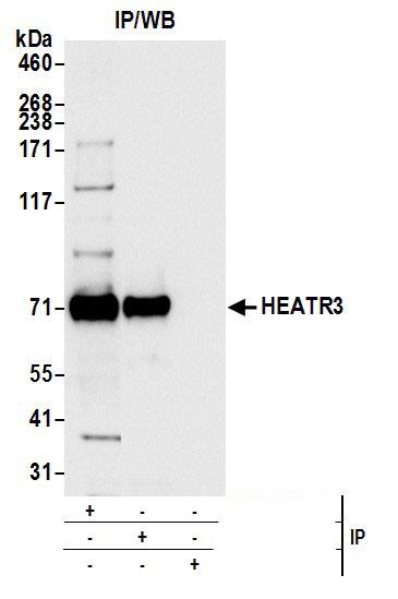 HEATR3 Antibody