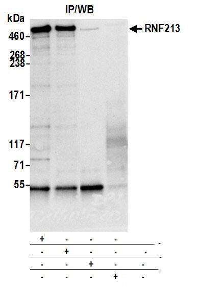 RNF213 Antibody