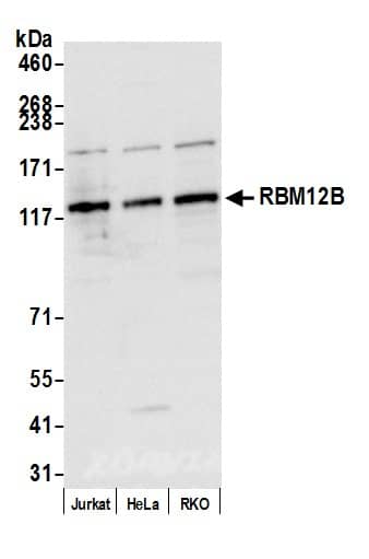 YTHD1 Antibody