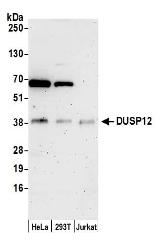 DUSP12 Antibody