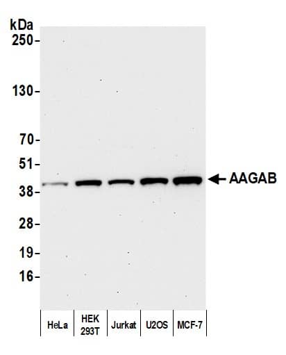 FLJ11506 Antibody