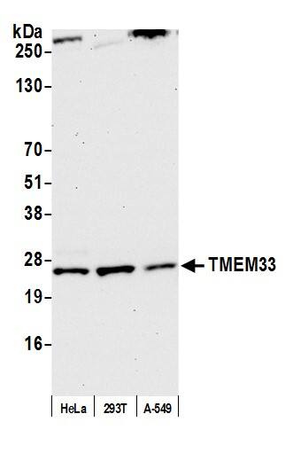 TMEM33 Antibody