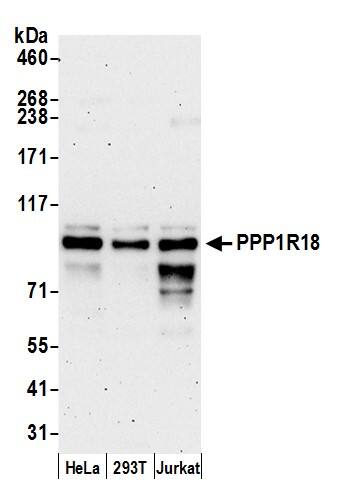 PPP1R18 Antibody