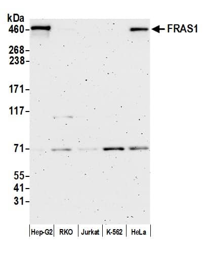 FRAS1 (Fraser syndrome 1) Antibody