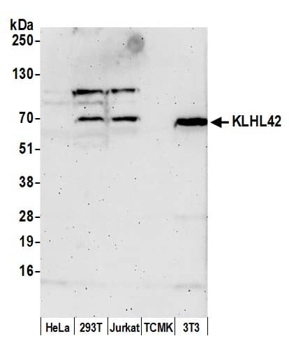 KLHDC5 Antibody