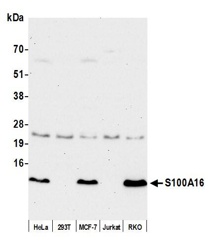 S100A16 Antibody