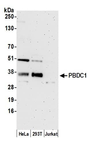 PBDC1 Antibody