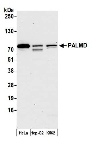 PALMD Antibody