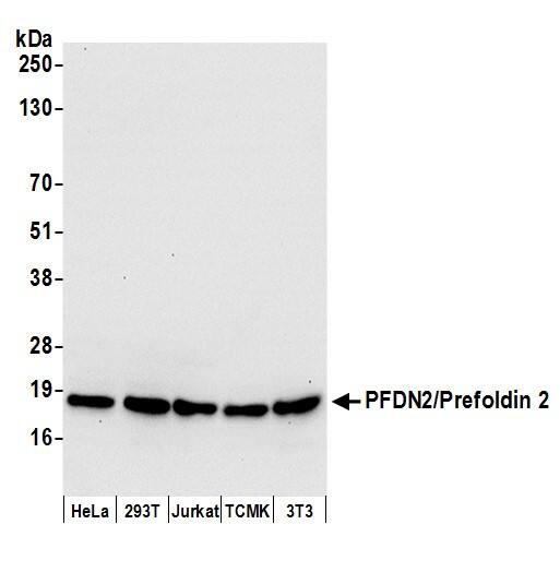 TRAPPC5 Antibody